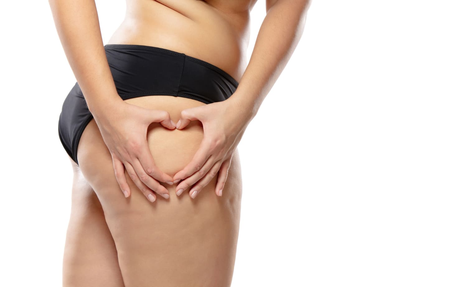 mesoterapia y celulitis