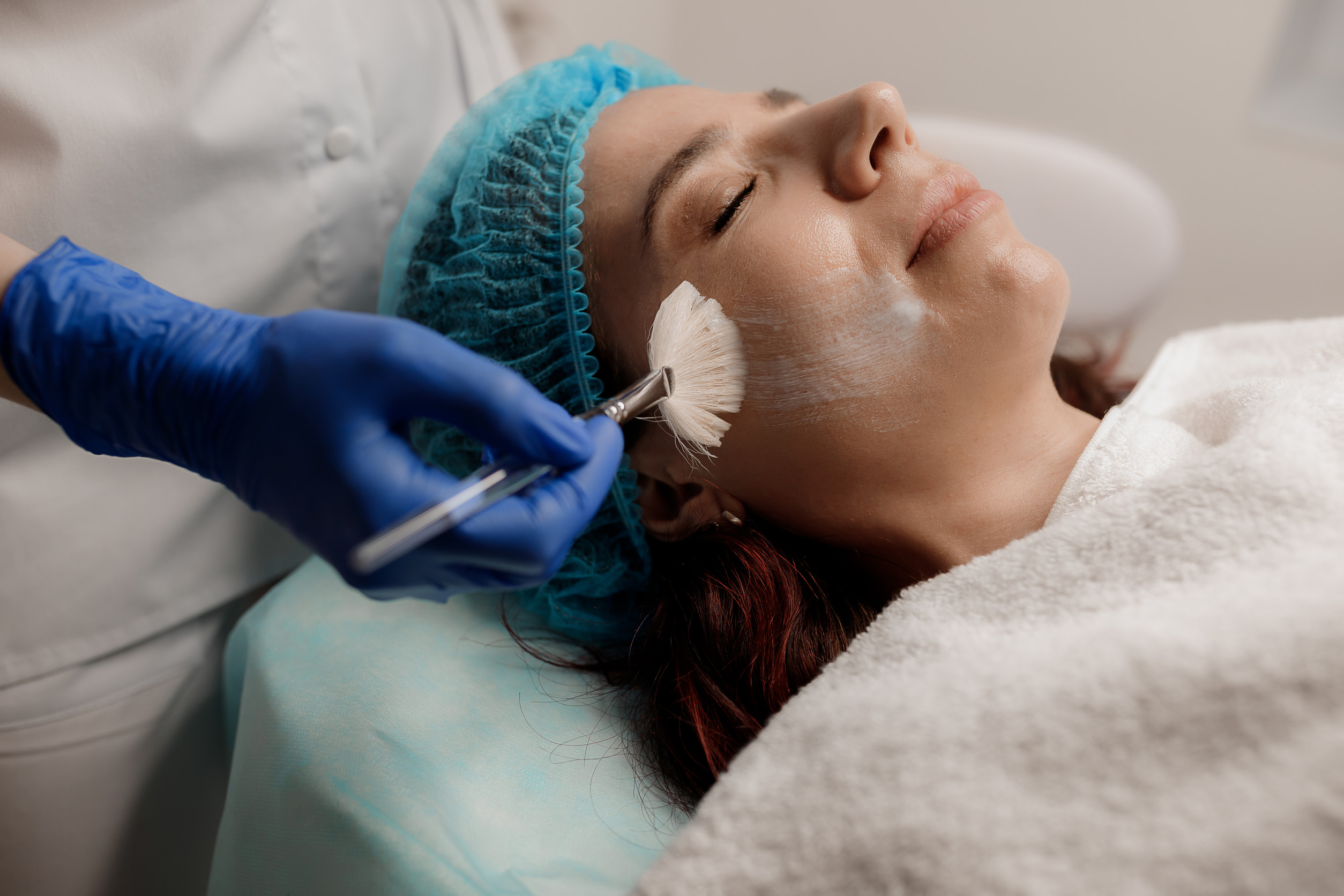 Tipos de peeling químico