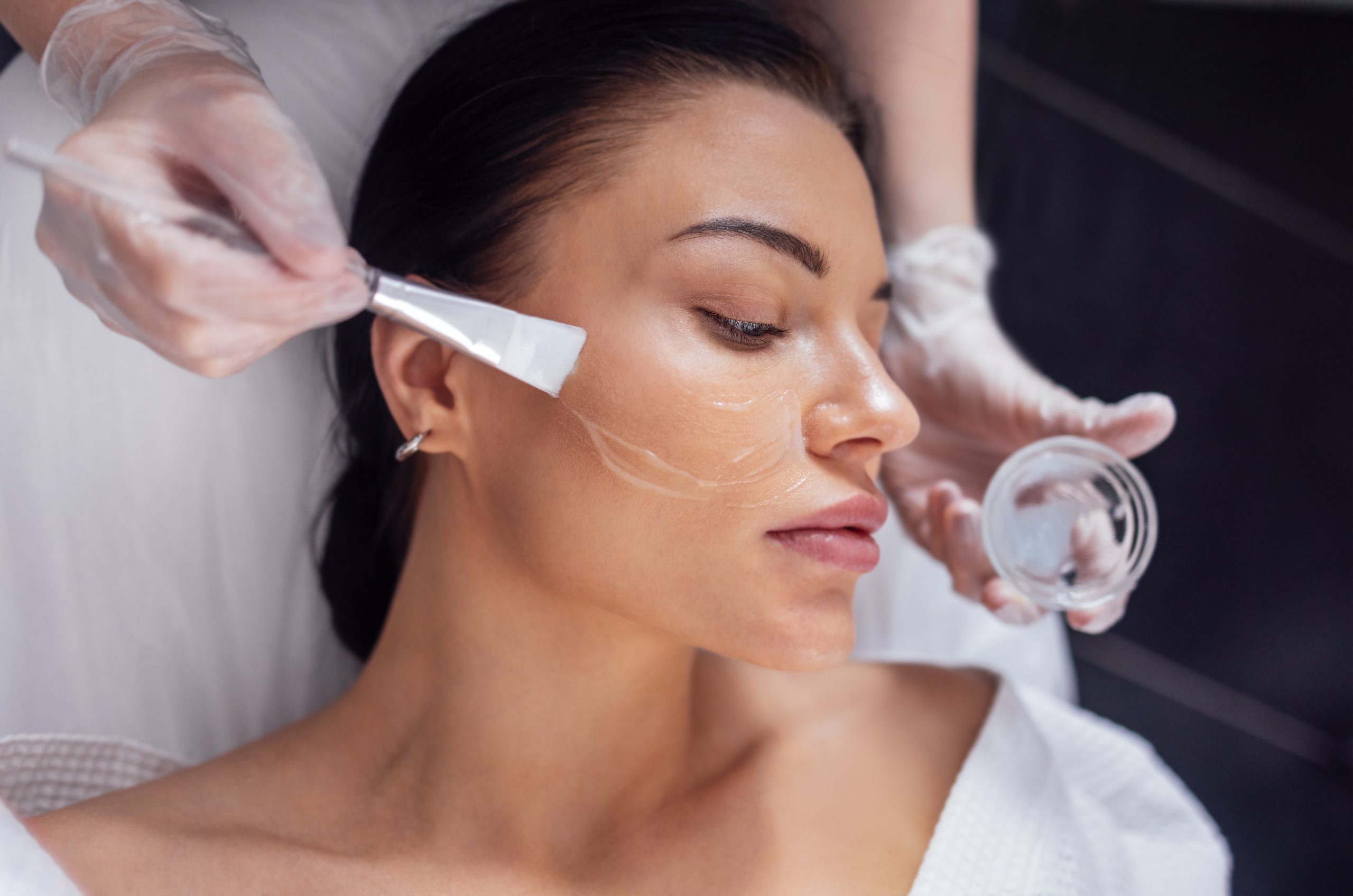 Qué cremas usar después de un peeling químico